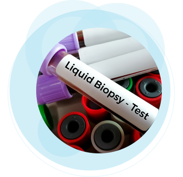 Teaser Liquid Biopsie blau