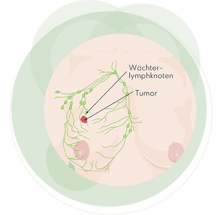 Teaeser Lypmphbahnen Kreise grün