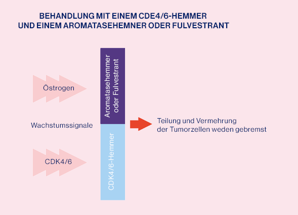 Teaser Knochenmetastasierter Brustkrebs CDK4 und Antihormontherapie rosa hell
